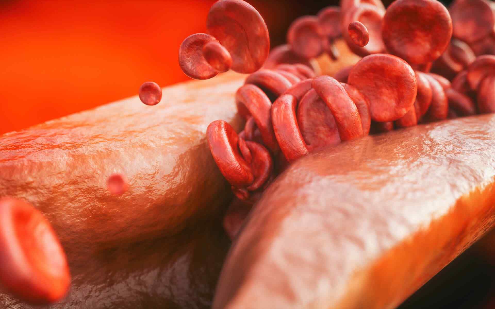 post_11 https://centrodeortopedia.org/wp-content/uploads/2018/04/post_11.jpg