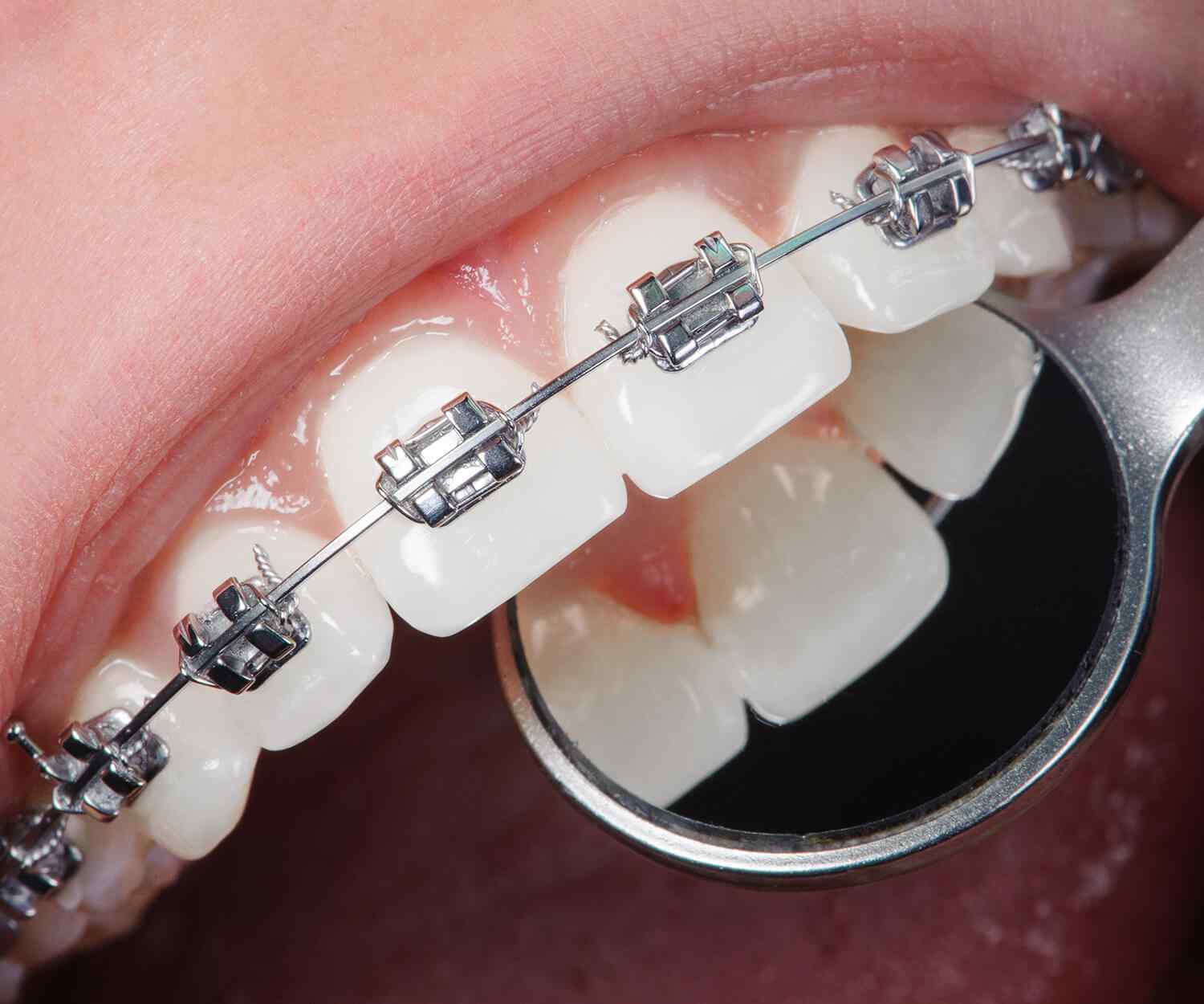 https://centrodeortopedia.org/wp-content/uploads/2021/10/card_image_home_03-03.jpg