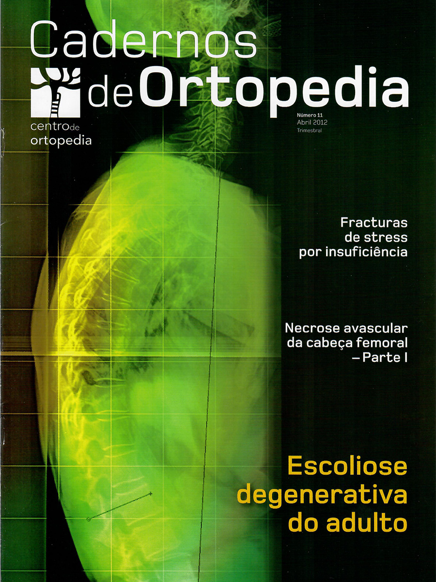 Cadernos de Ortopedia Nr11