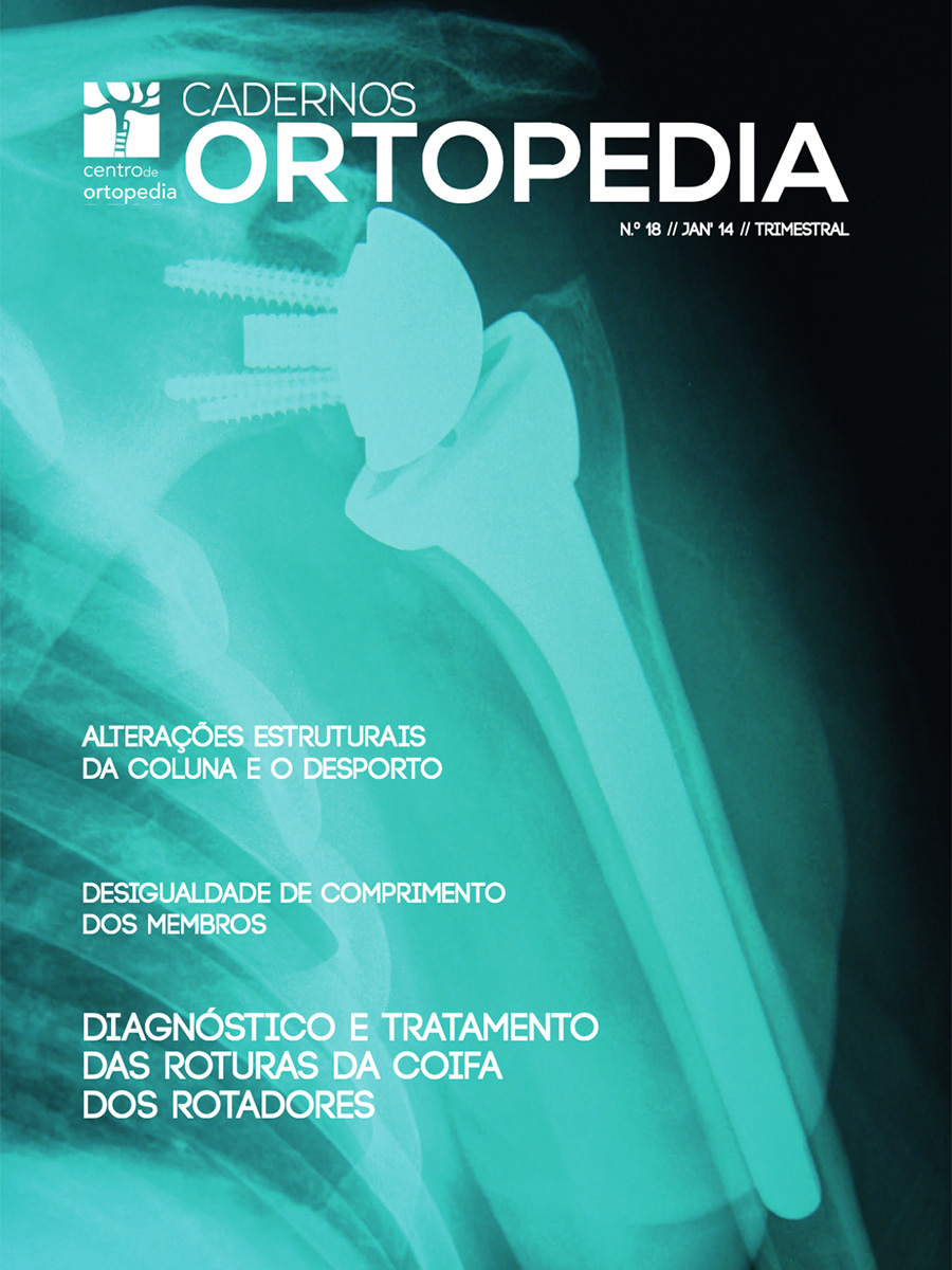 Cadernos de Ortopedia Nº 18