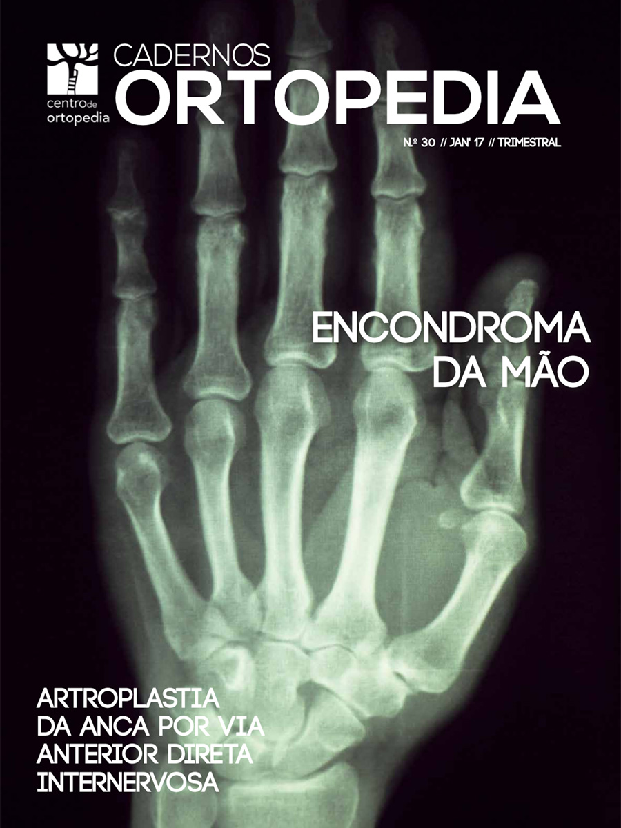 Cadernos de Ortopedia Nº 30