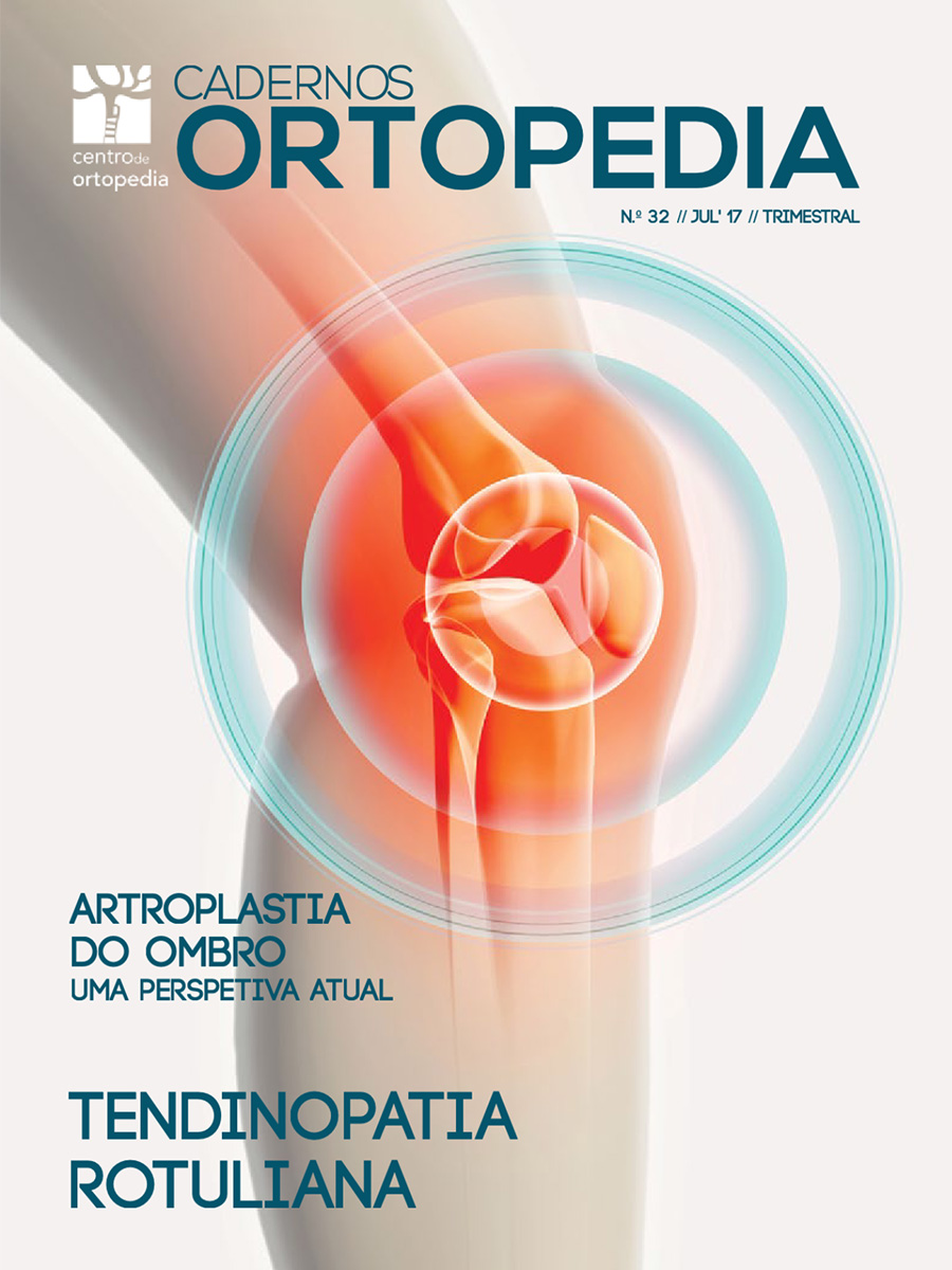 Cadernos de Ortopedia Nº 32