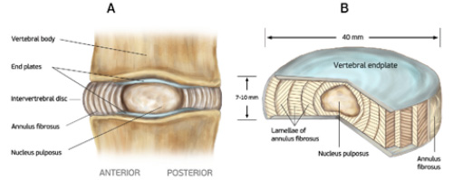 UnidColuna_Patologia_Disco Intervertebral