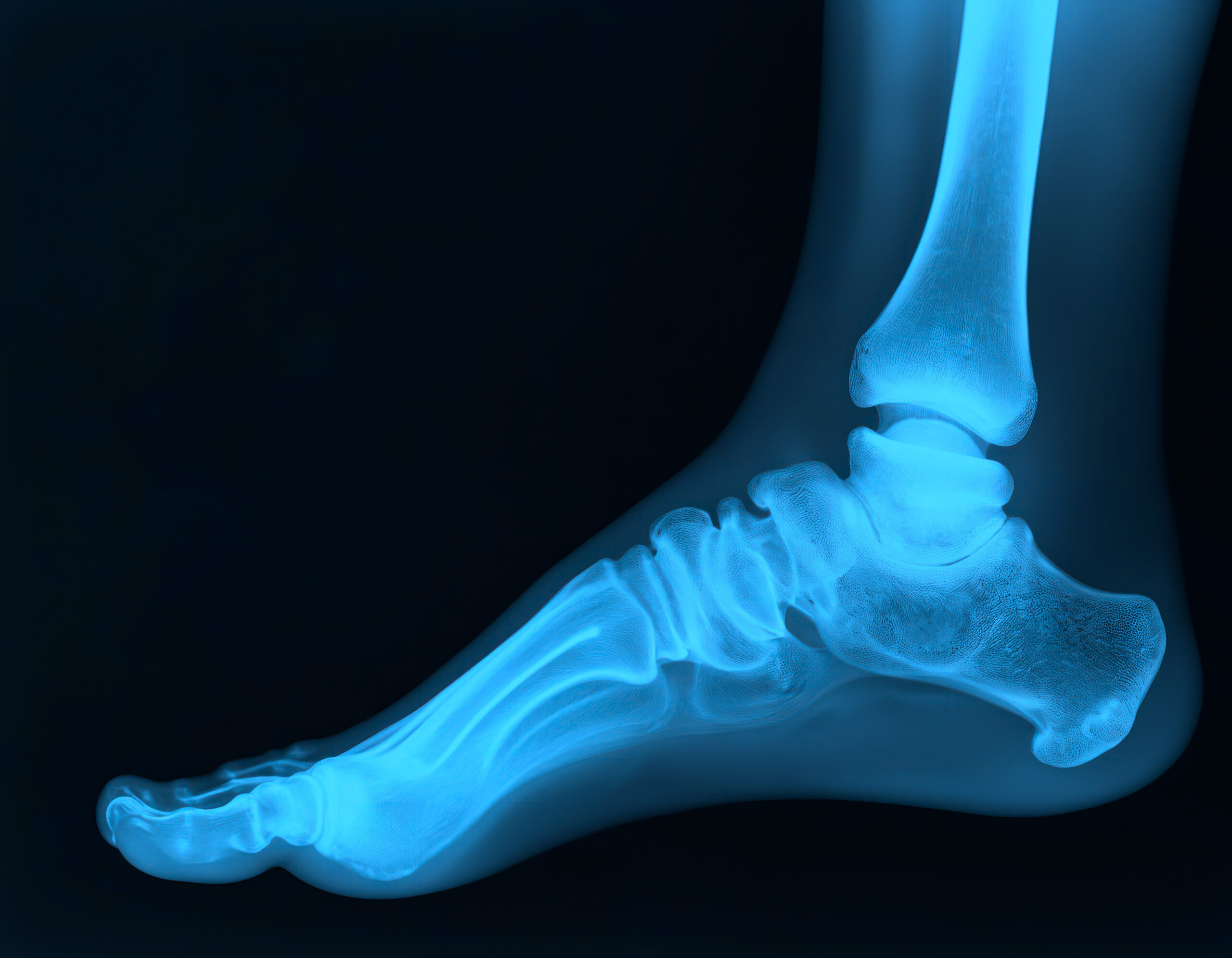 human foot 